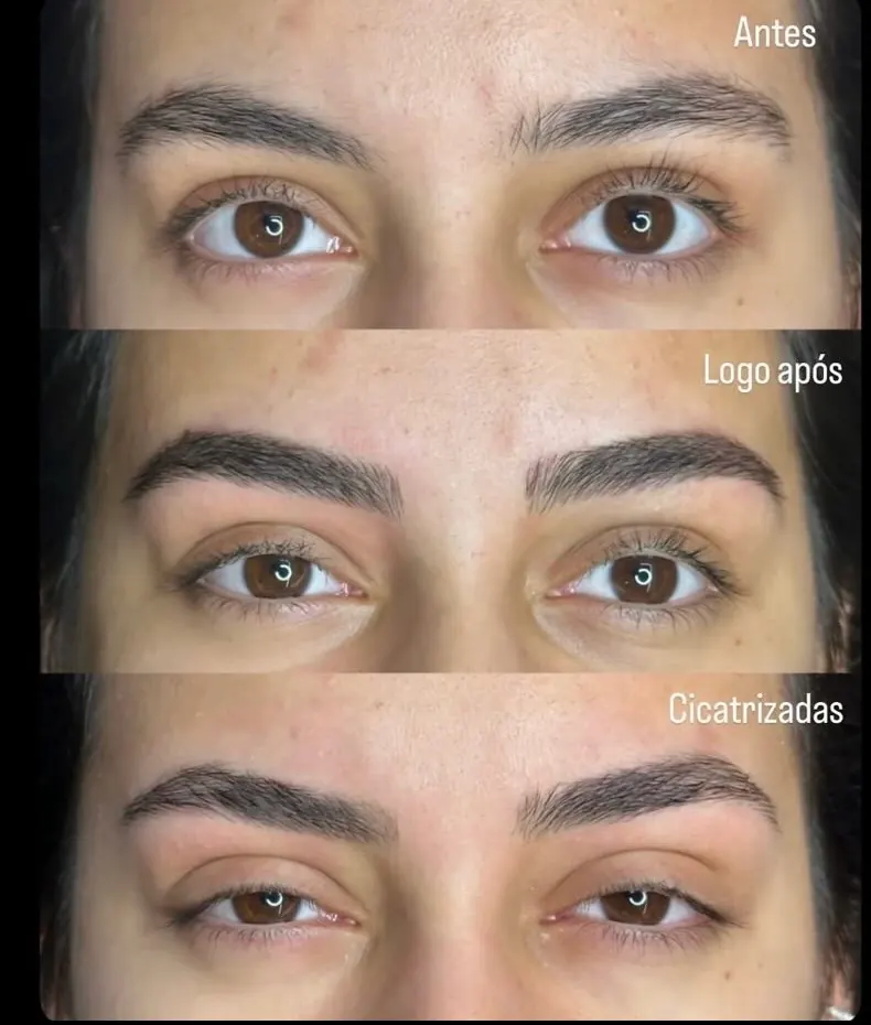 Resultado de tratamento